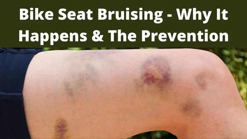 bike seat bruising
